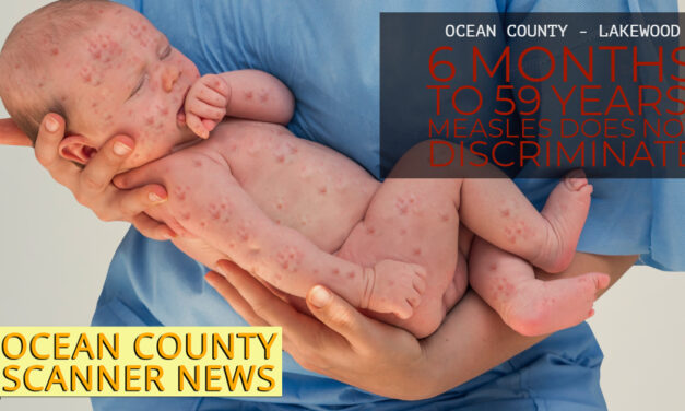 OCEAN COUNTY – LAKEWOOD: Measles Outbreak Affects All Ages